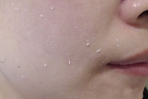 Primera Facial Mild Peeling sau khi thoa lên mặt